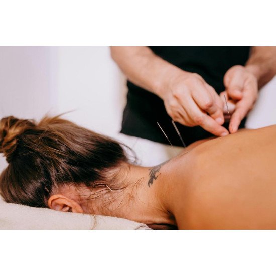 Dry Needling Therapy