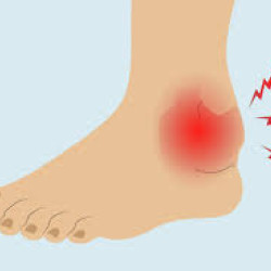 Ankle Issues