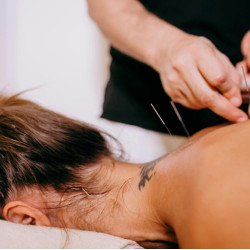 Acupuncture Therapy